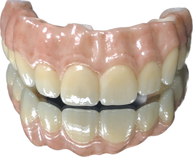 Invisalign Minneapolis