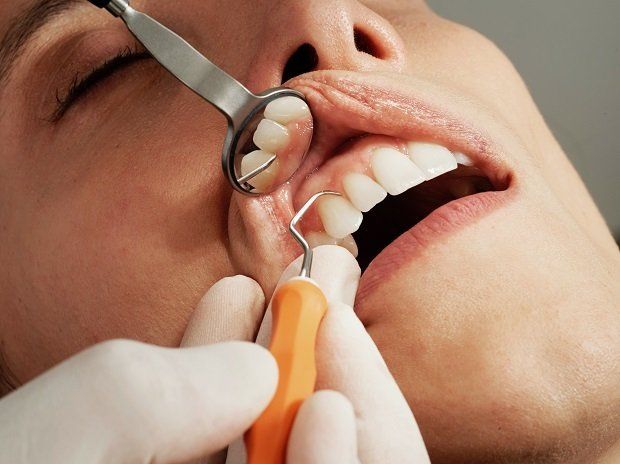Gum disease Gum disease