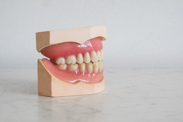 Dental Crowns Dental Crowns