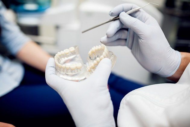 Dental Crowns Dental Crowns