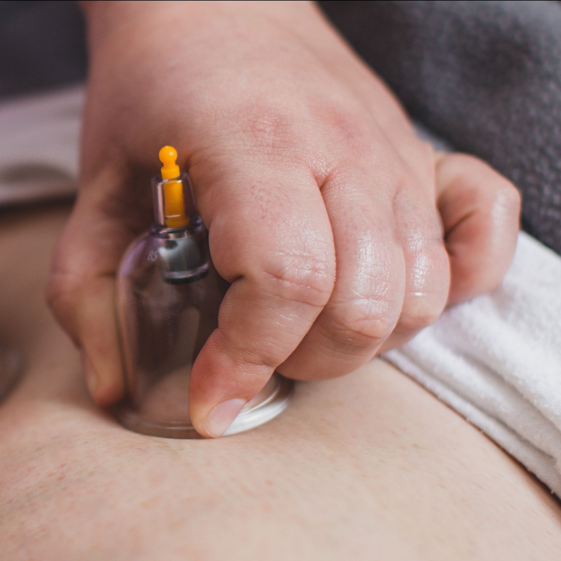 a person is getting a cupping treatment on their leg .