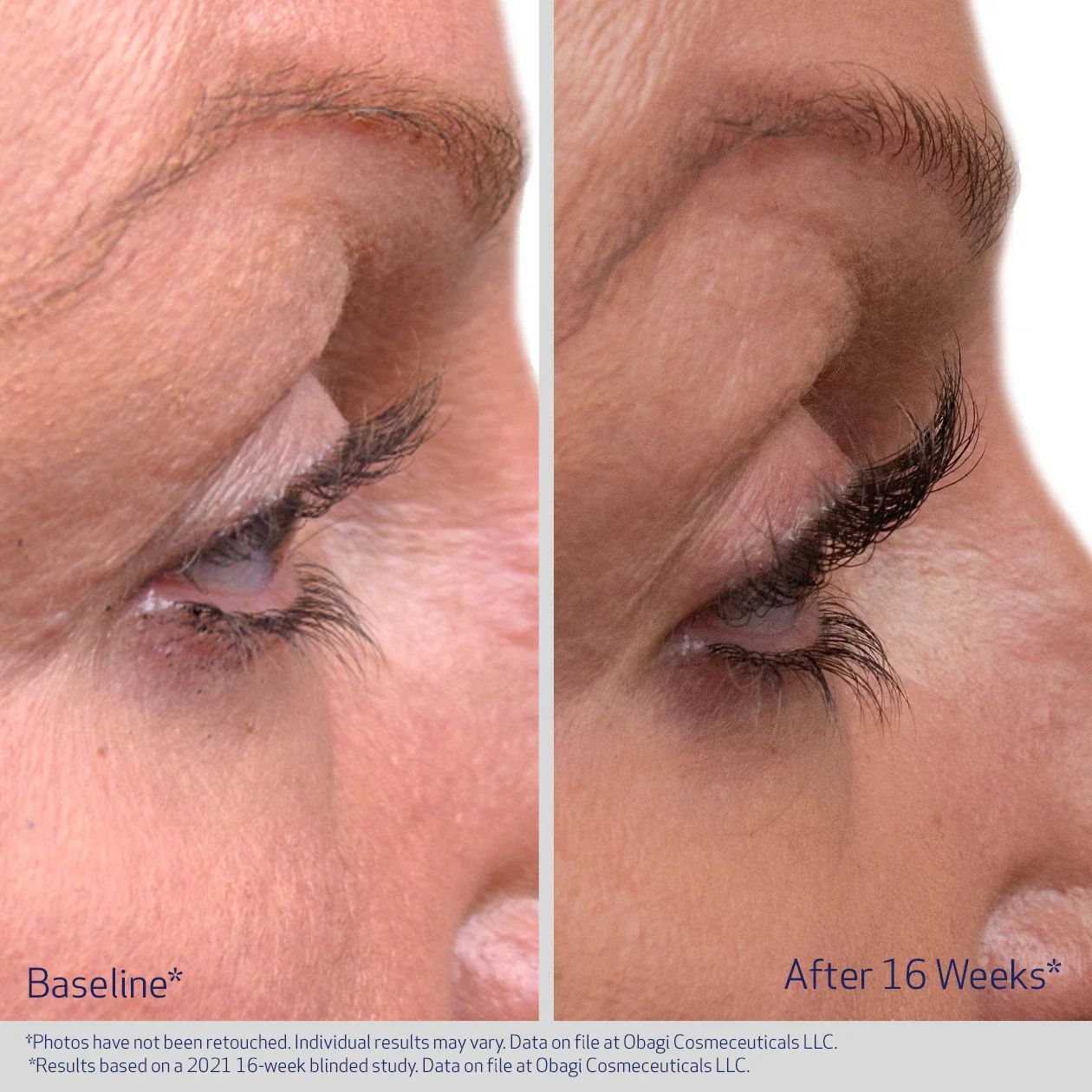 latisse product