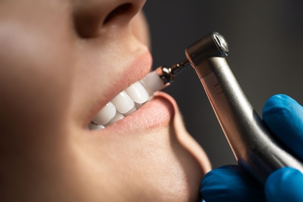 A dental drill being used on a patient's teeth during a procedure.