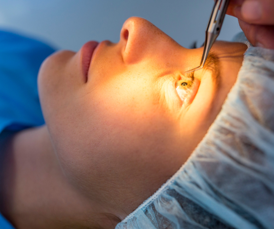 LASIK | South Shore Eye Care | Services