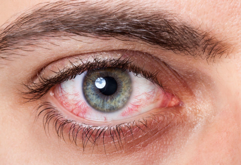 All You Need to Know about Corneal Transplants | South Shore Eye Care
