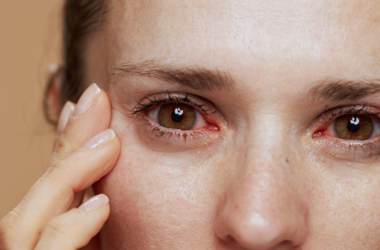 Dry Mouth, Dry Eyes: Understanding the Link and How to Treat Both | South Shore Eye Care