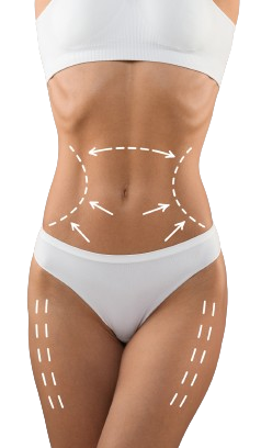 Body of a woman