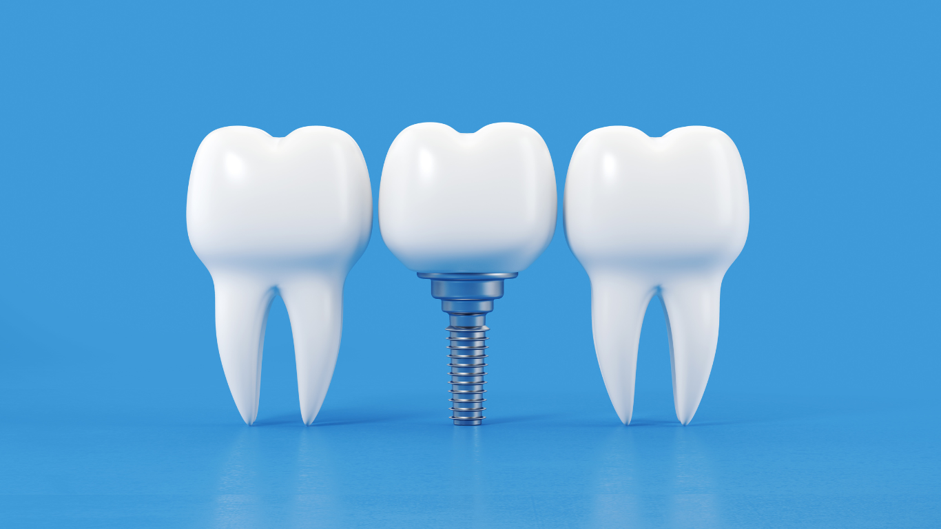 Three tooth implants are sitting next to each other on a blue surface.