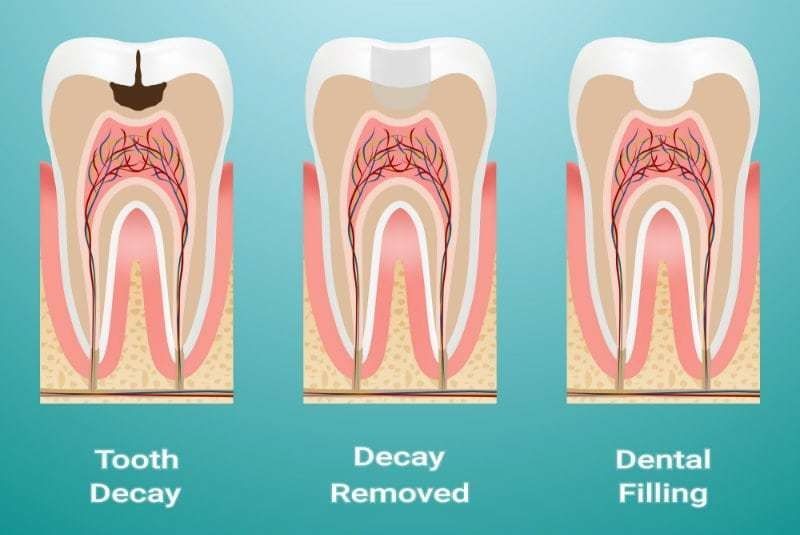 A dentist is holding a model of a person 's teeth with a light on it.