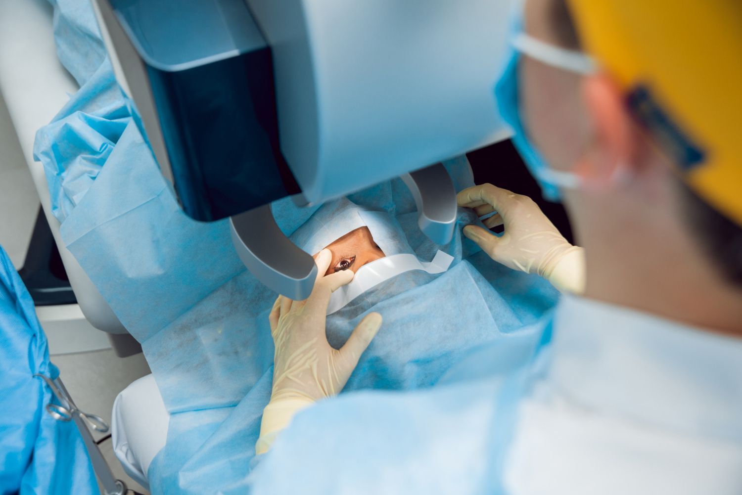 operation des yeux au laser