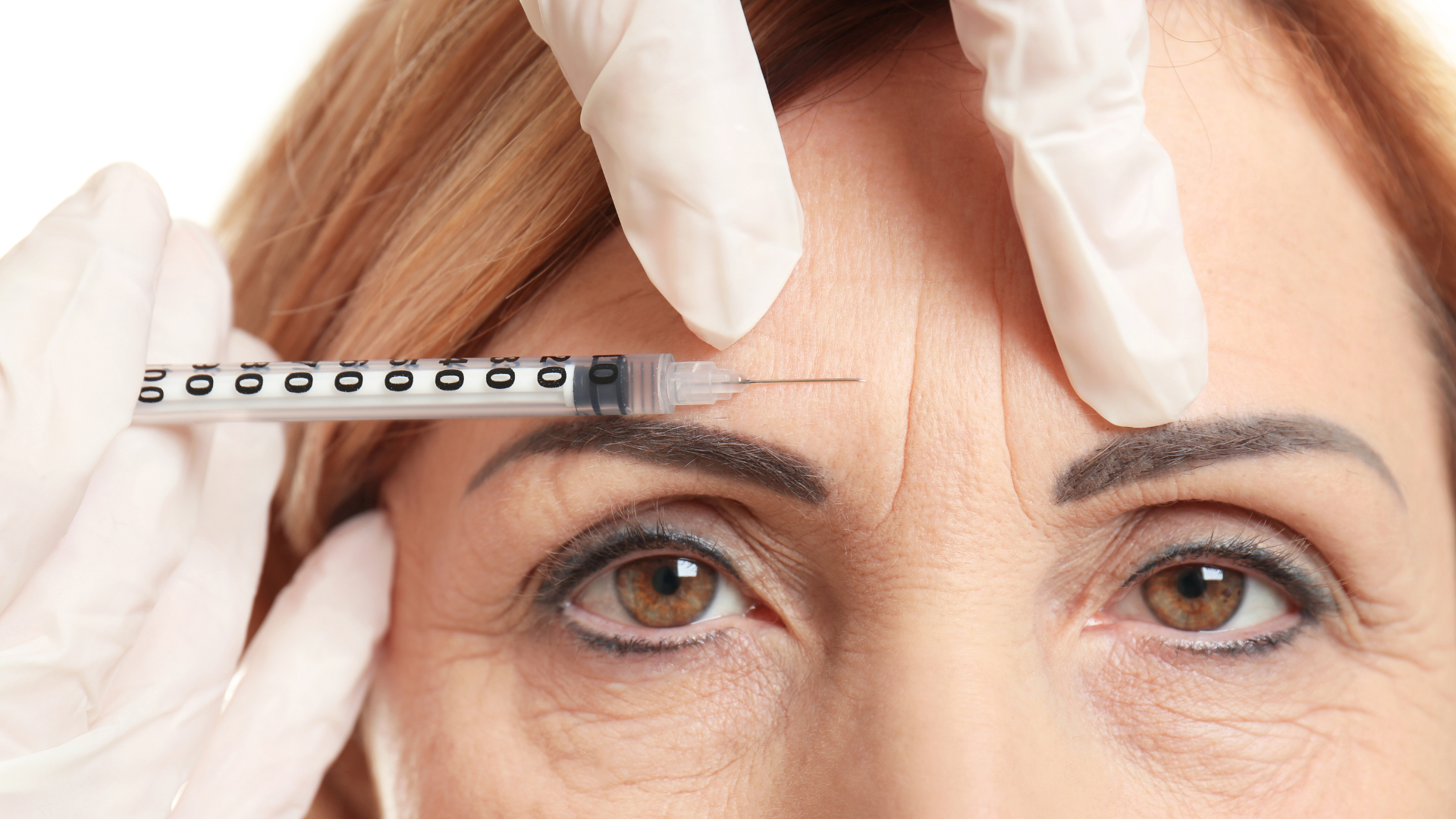 injection andre tuil botox regard