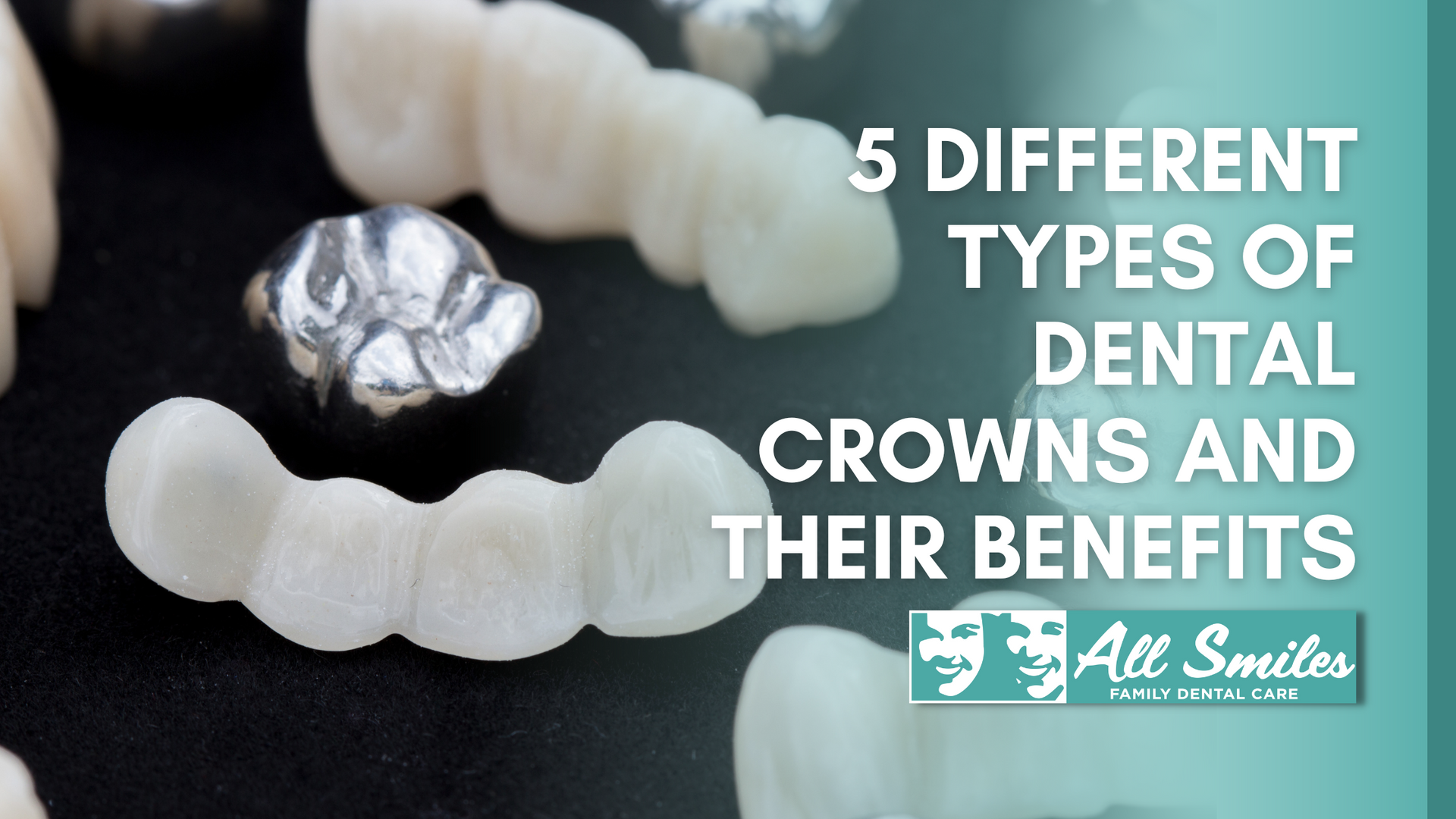 5 different types of dental crowns and their benefits