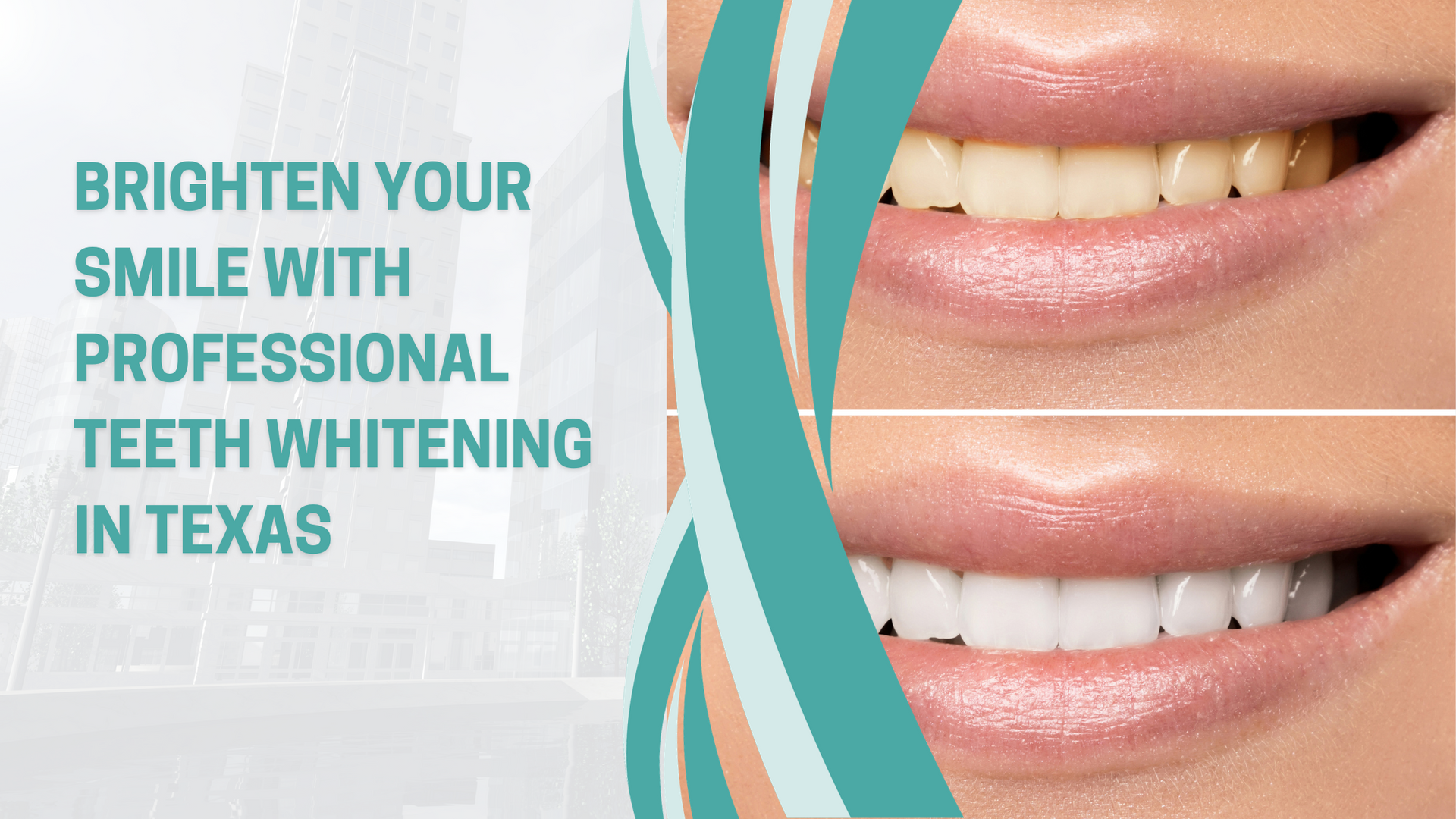 A before and after photo of a woman 's teeth whitening in texas.