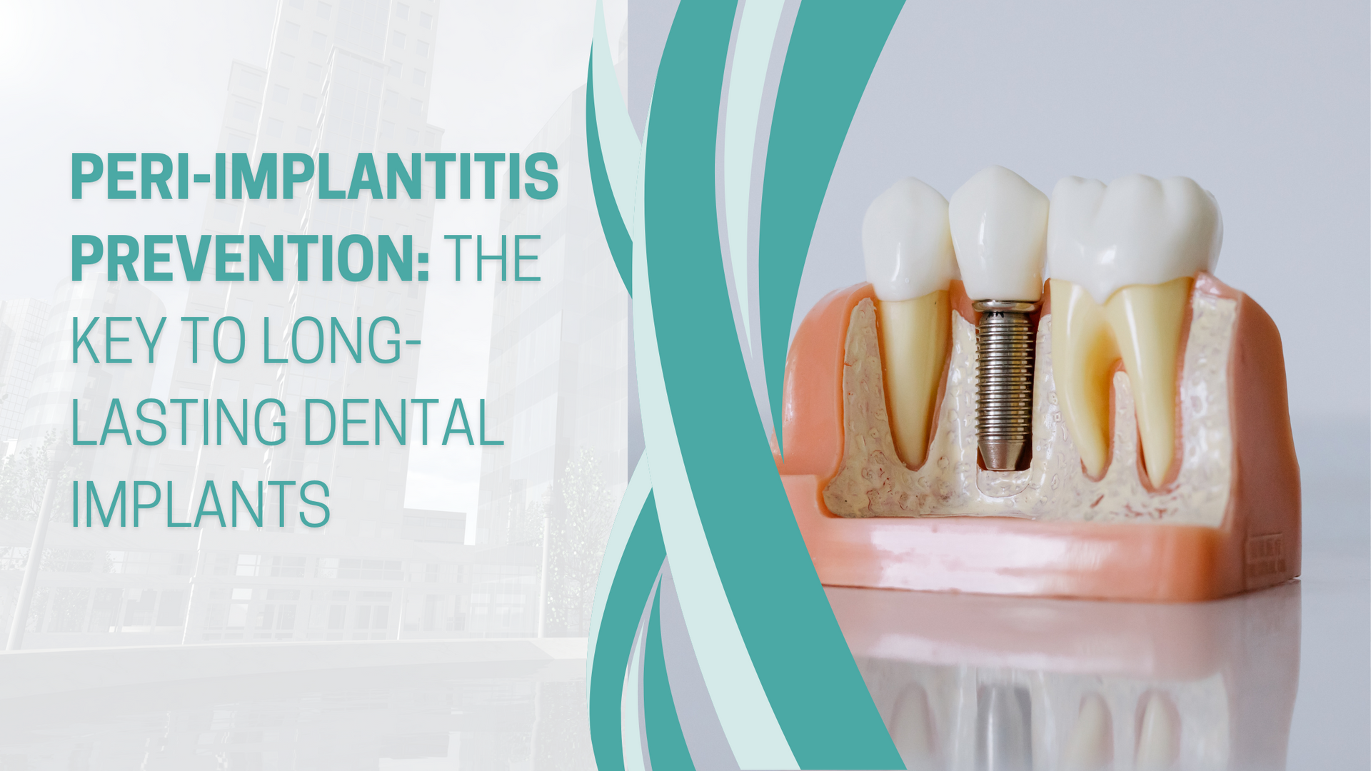 Dental implant model with text:
