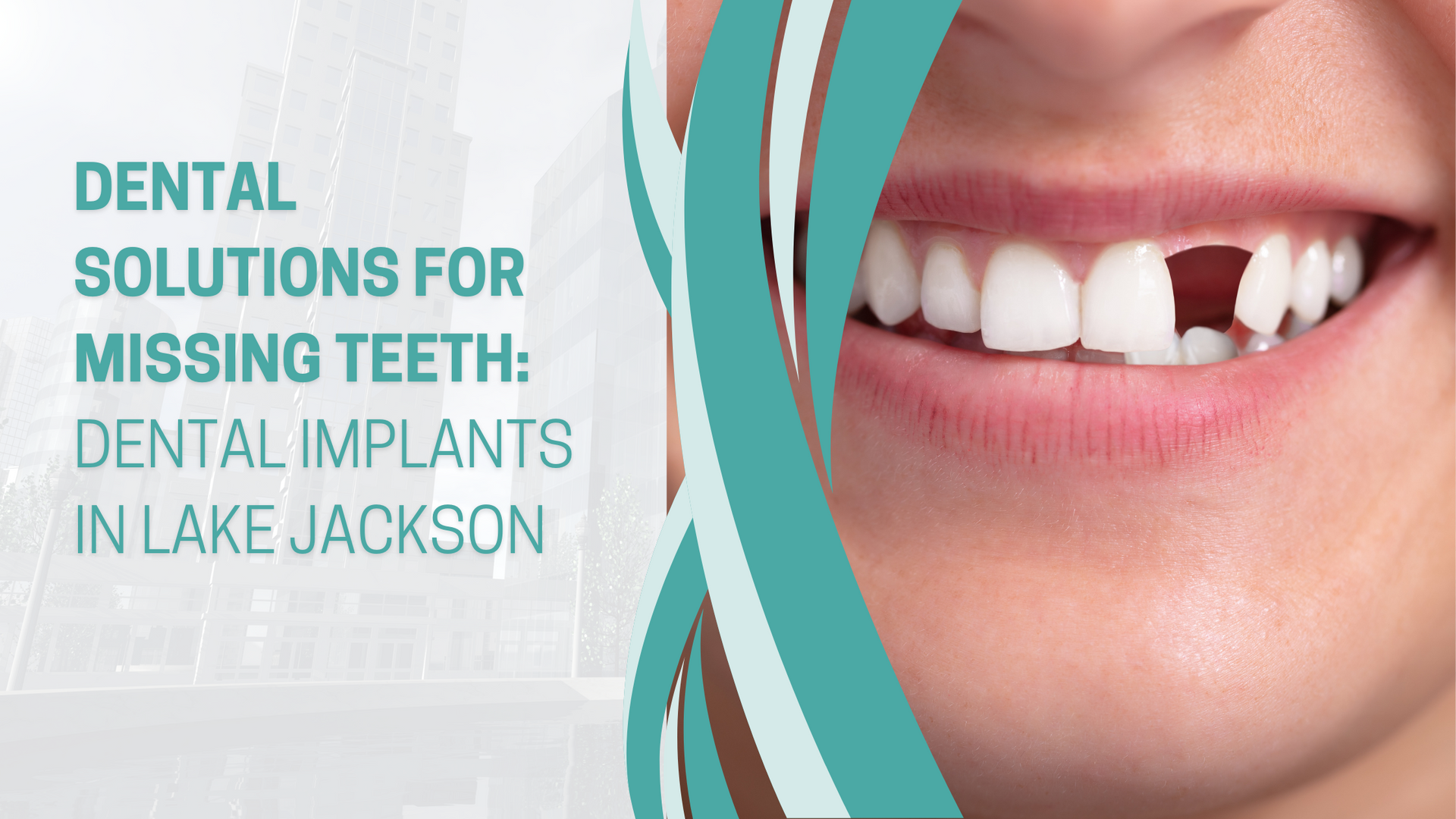 Dental solutions for missing teeth : dental implants in lake jackson