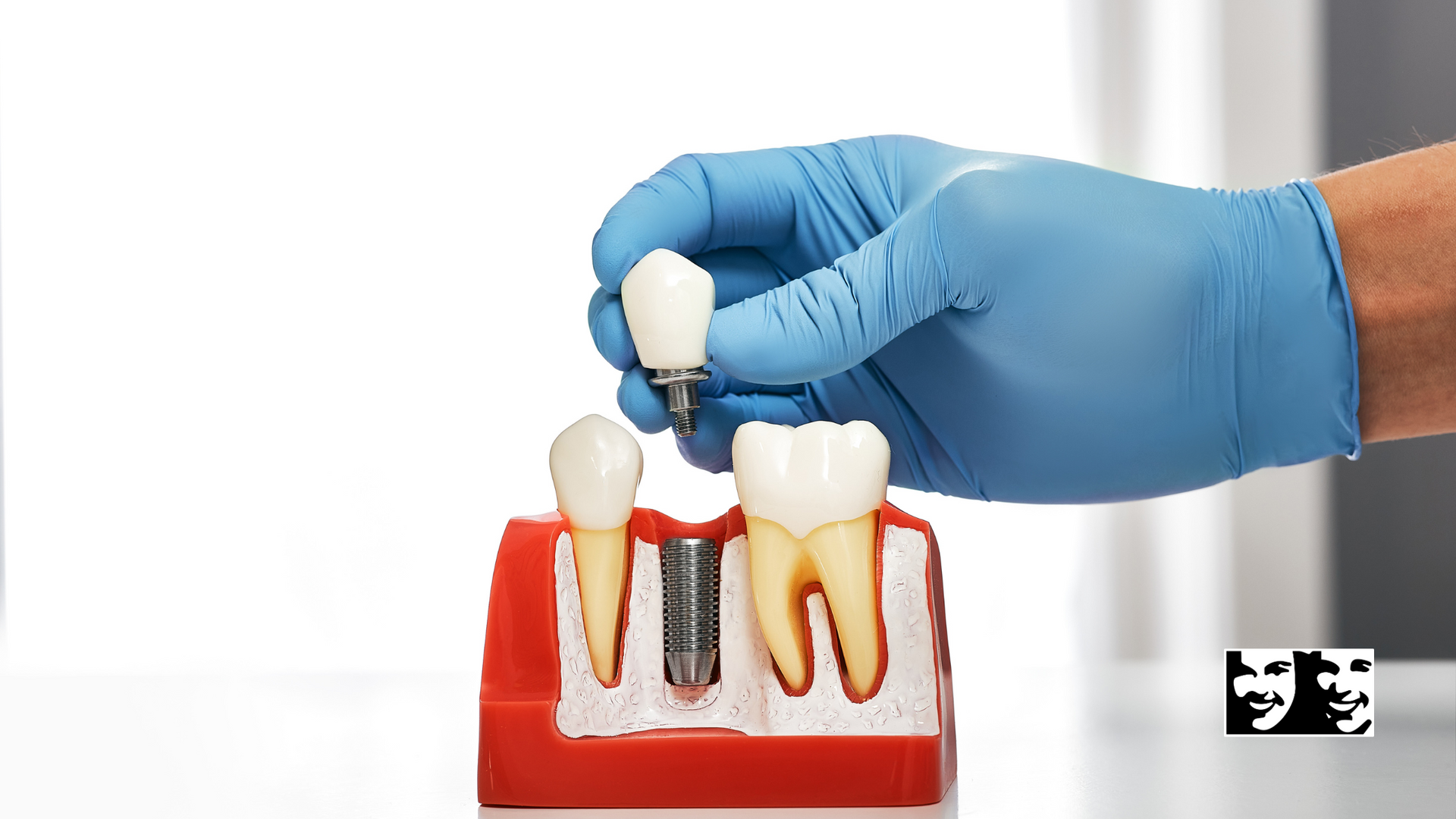 A dentist is putting a dental implant into a model of teeth.