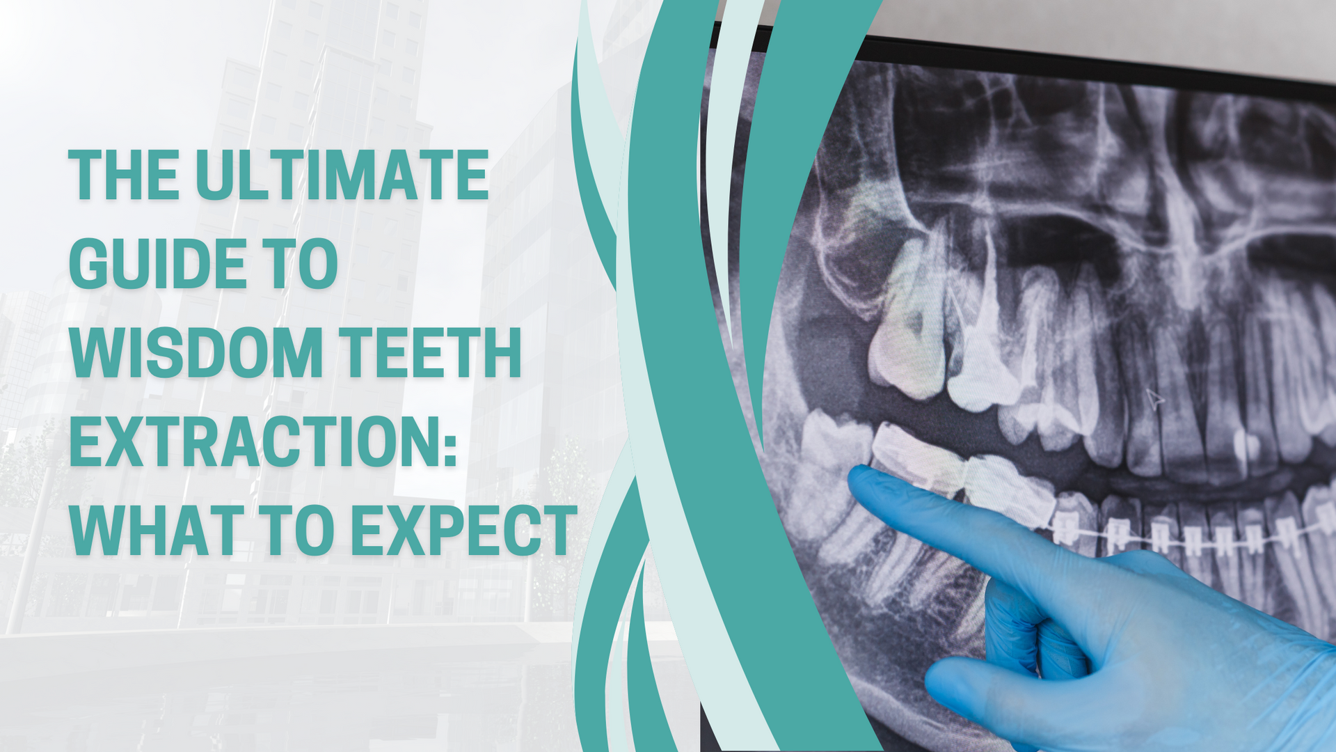 The ultimate guide to wisdom teeth extraction : what to expect