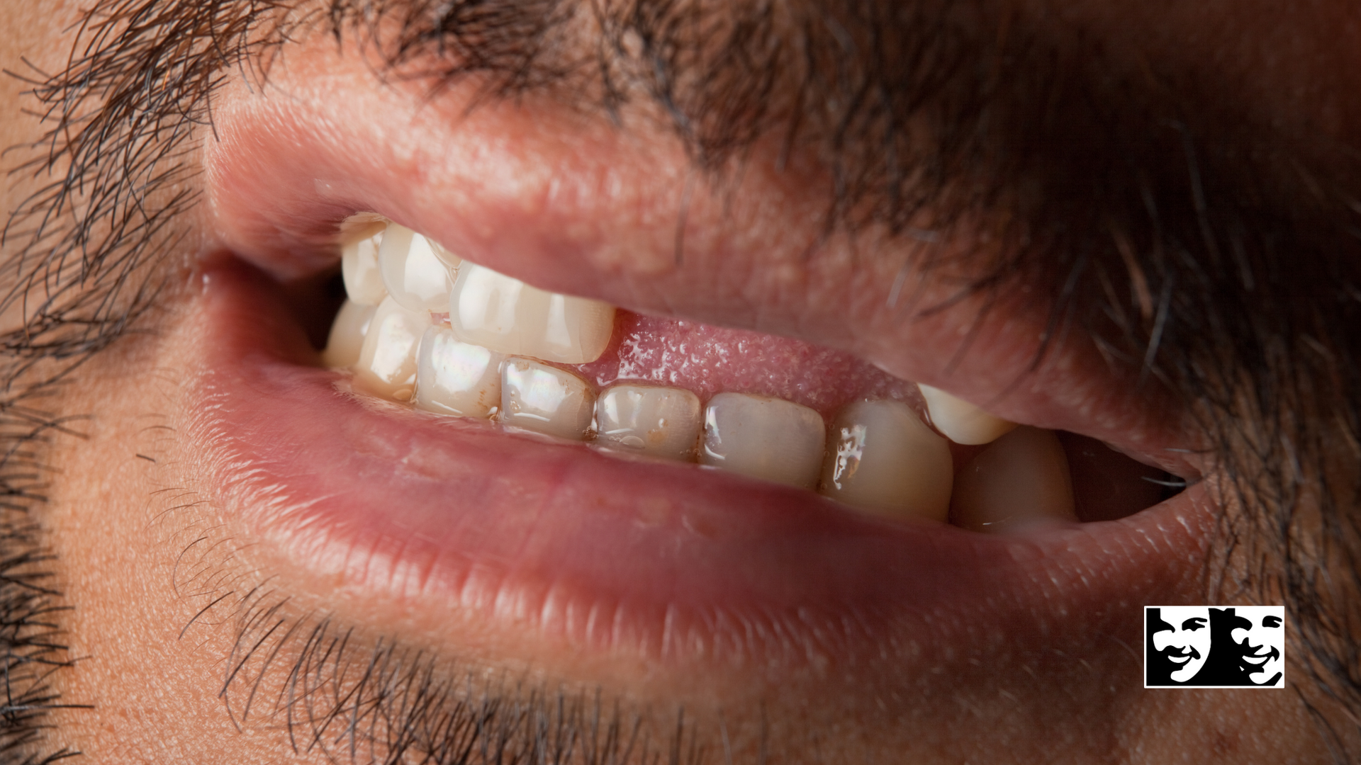 A close up of a man 's mouth with a beard and teeth.