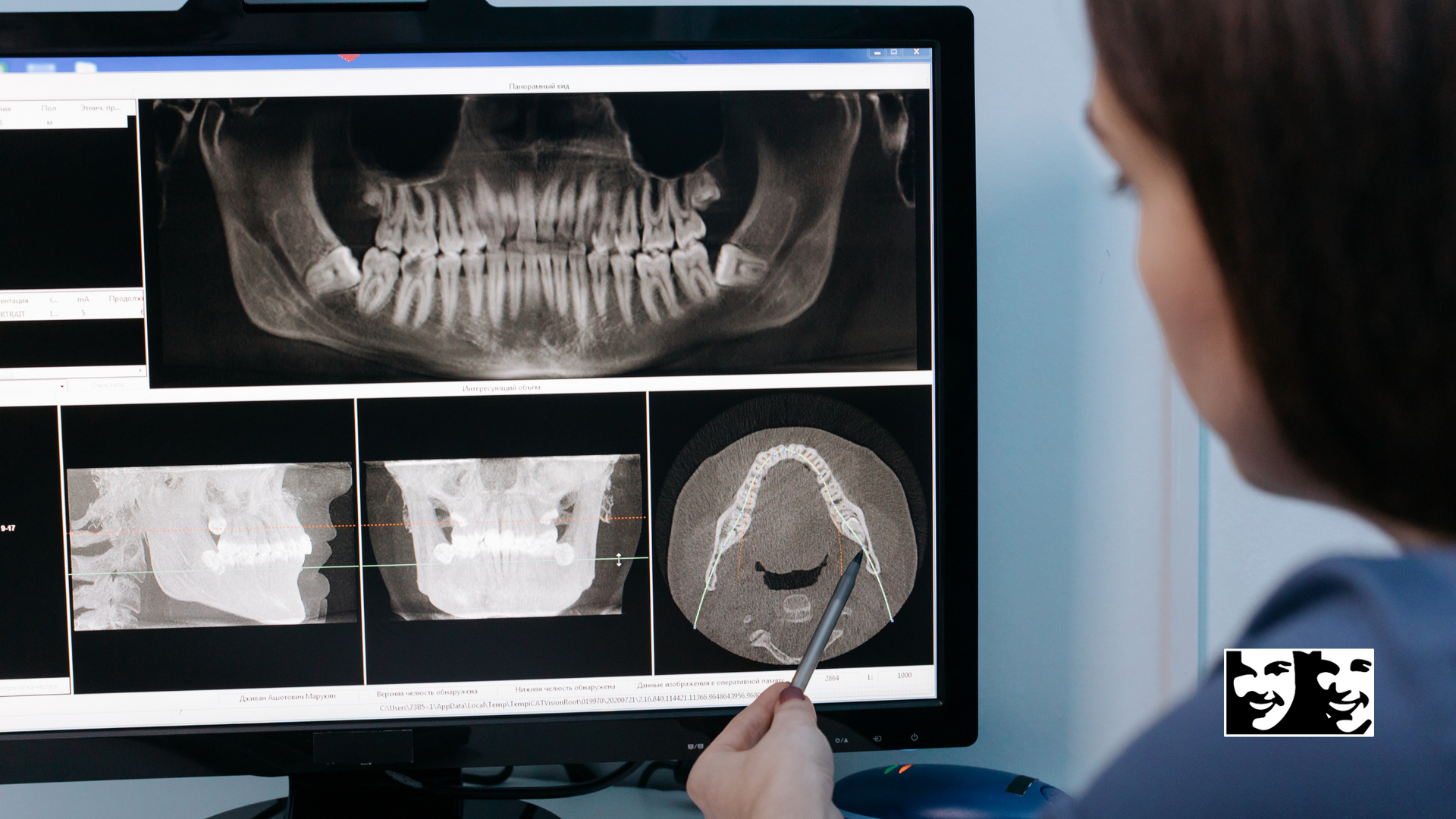 Dentist examines dental X-rays on a computer screen, pointing with a pen in a clinic setting.