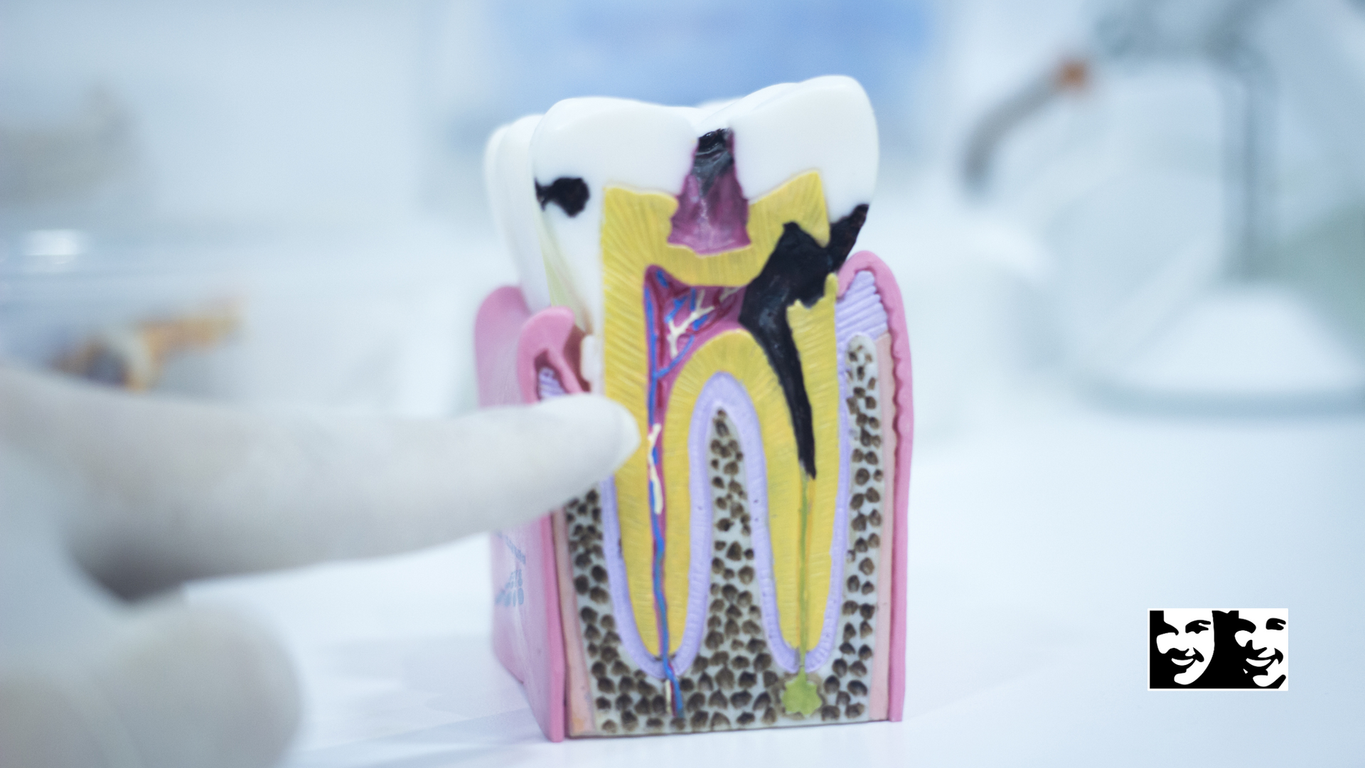 A person is pointing at a model of a tooth.
