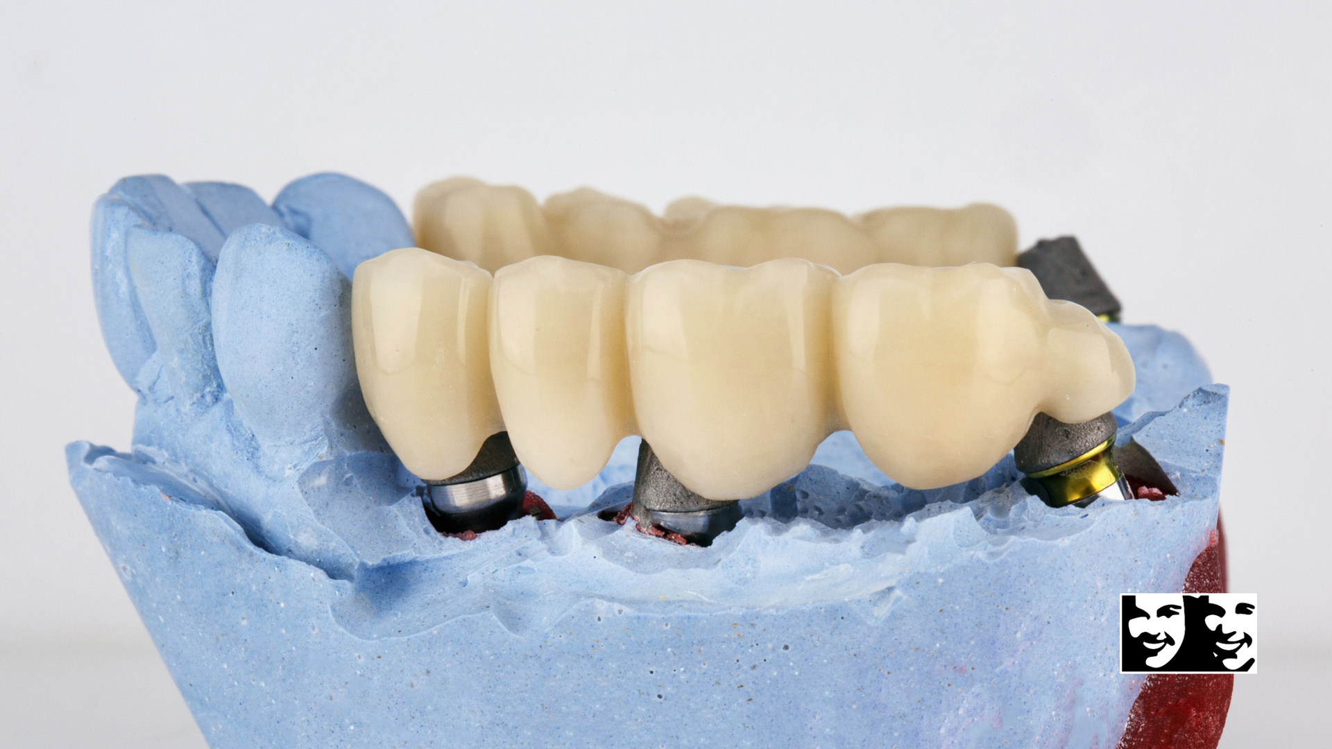 A model of a person 's teeth is sitting on a blue surface.