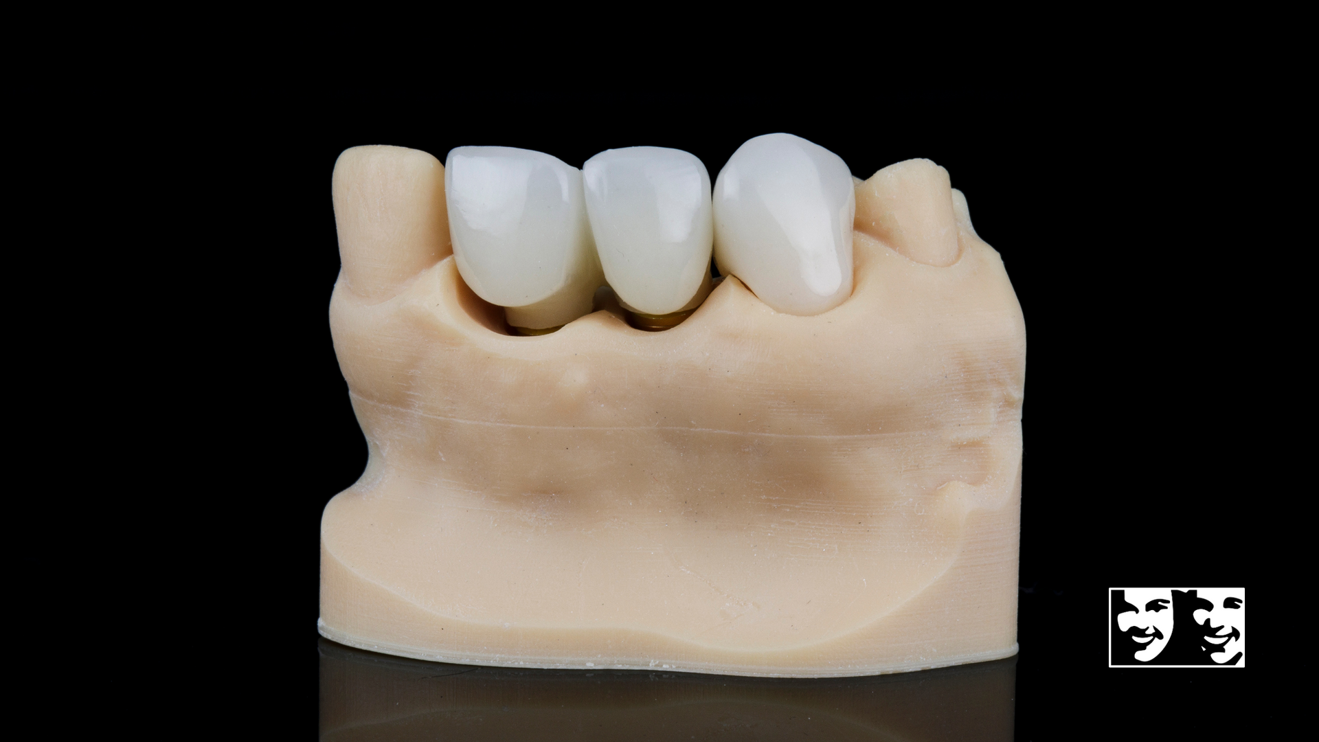 A model of a person 's teeth with a black background