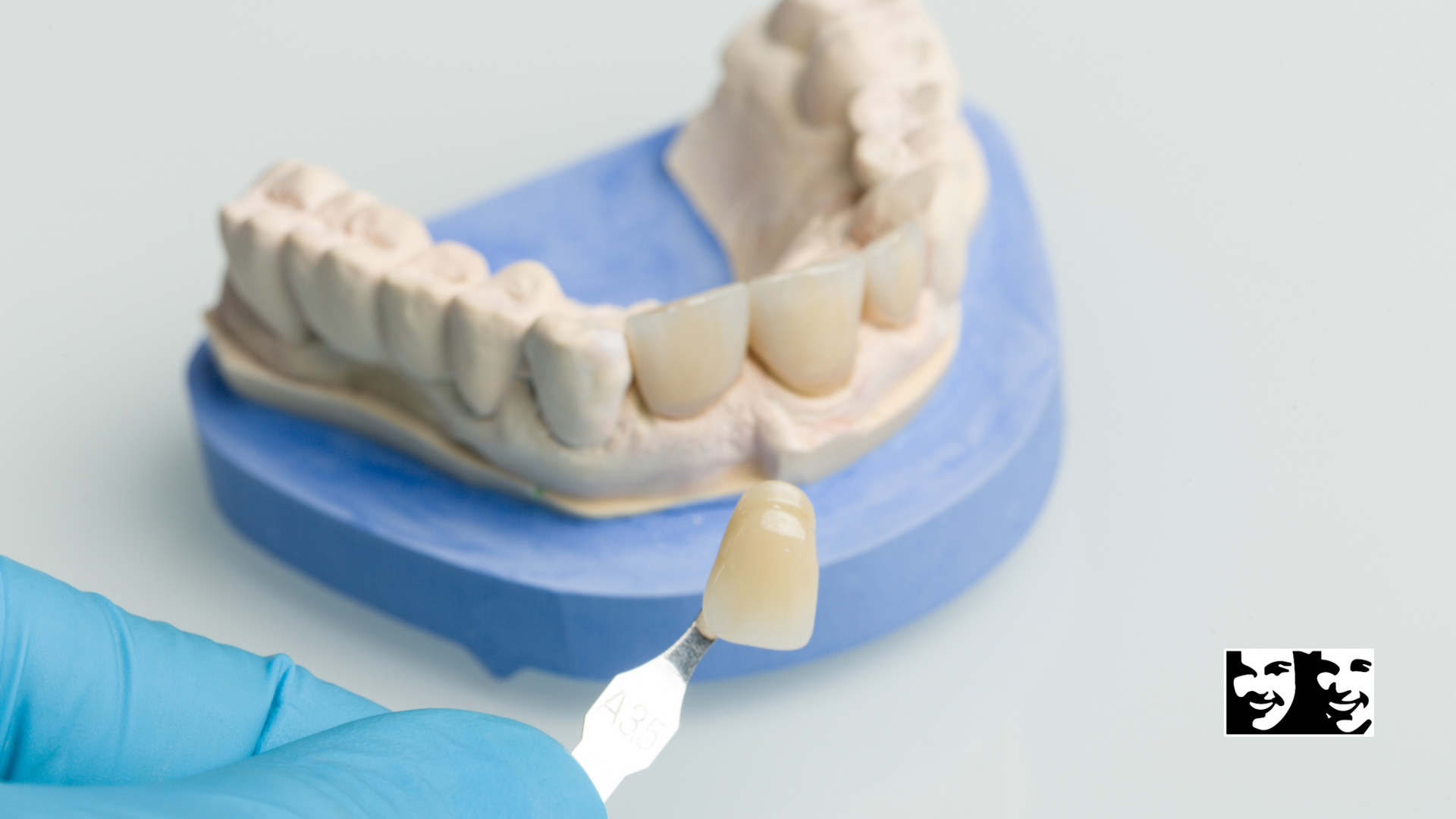 A model of a person 's teeth with a dental crown on it.