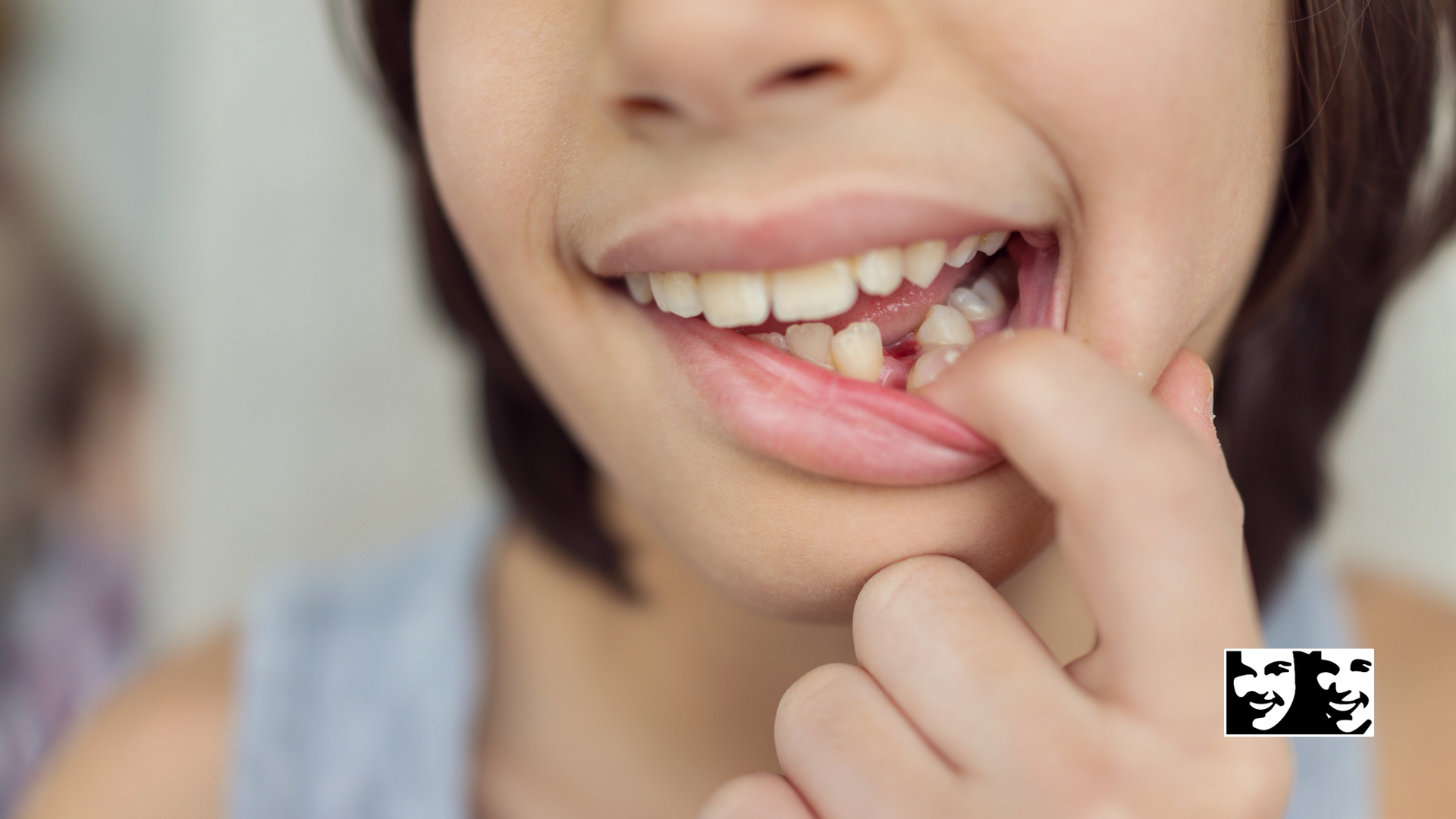 A close up of a person 's mouth with a missing tooth.