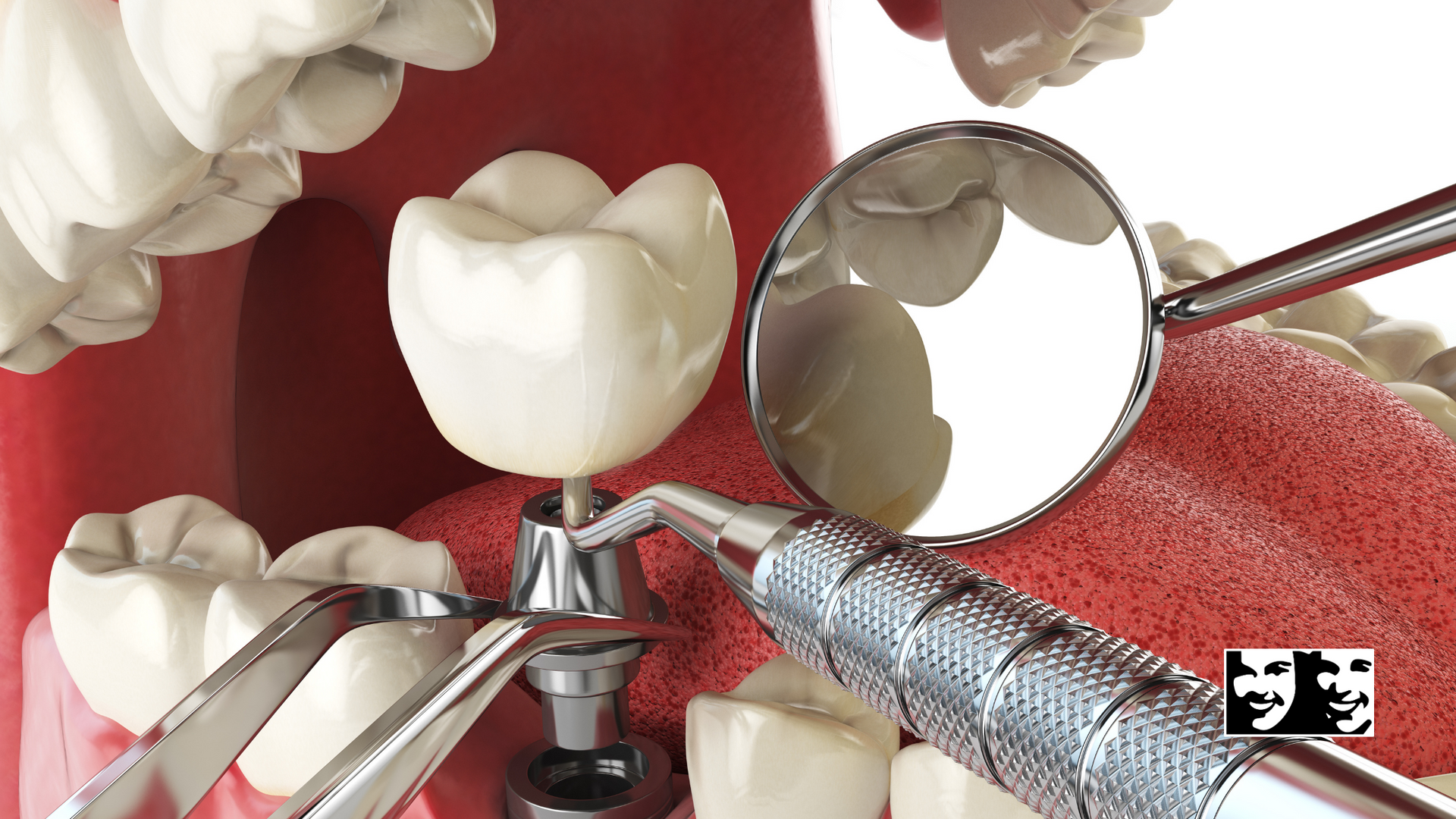 A dental implant is being examined by a dentist.
