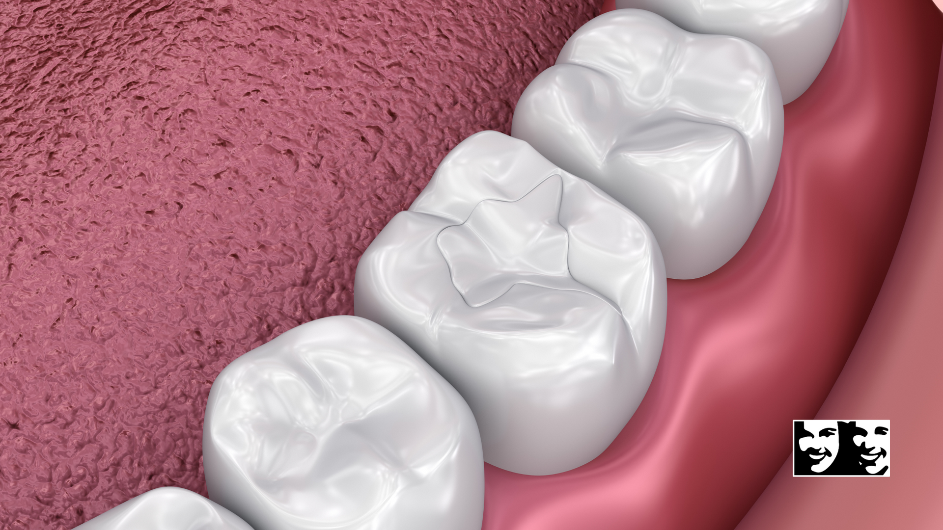 A close up of a person 's teeth and gums