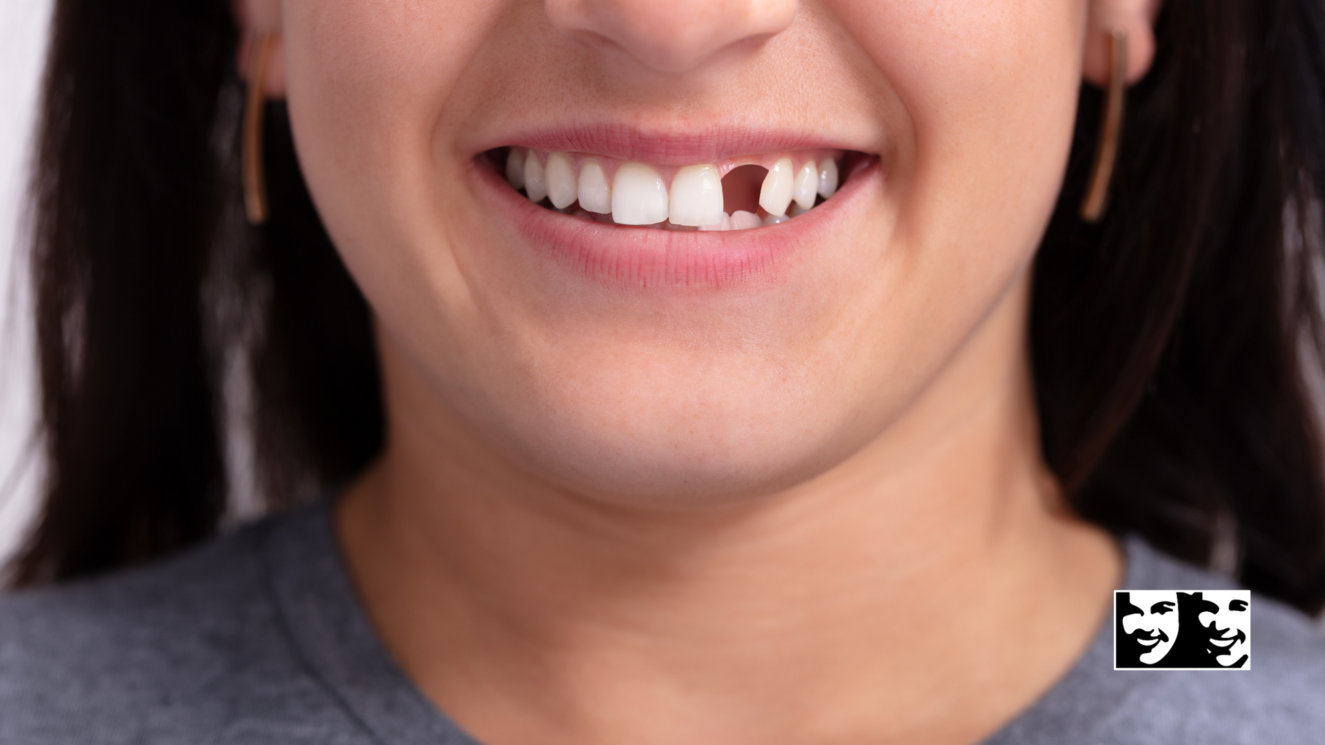 A close up of a woman 's mouth with a missing tooth