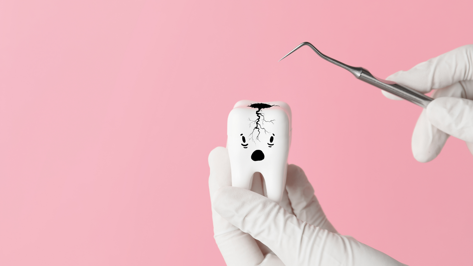 A dentist is holding a tooth with a hole in it and a dental probe.