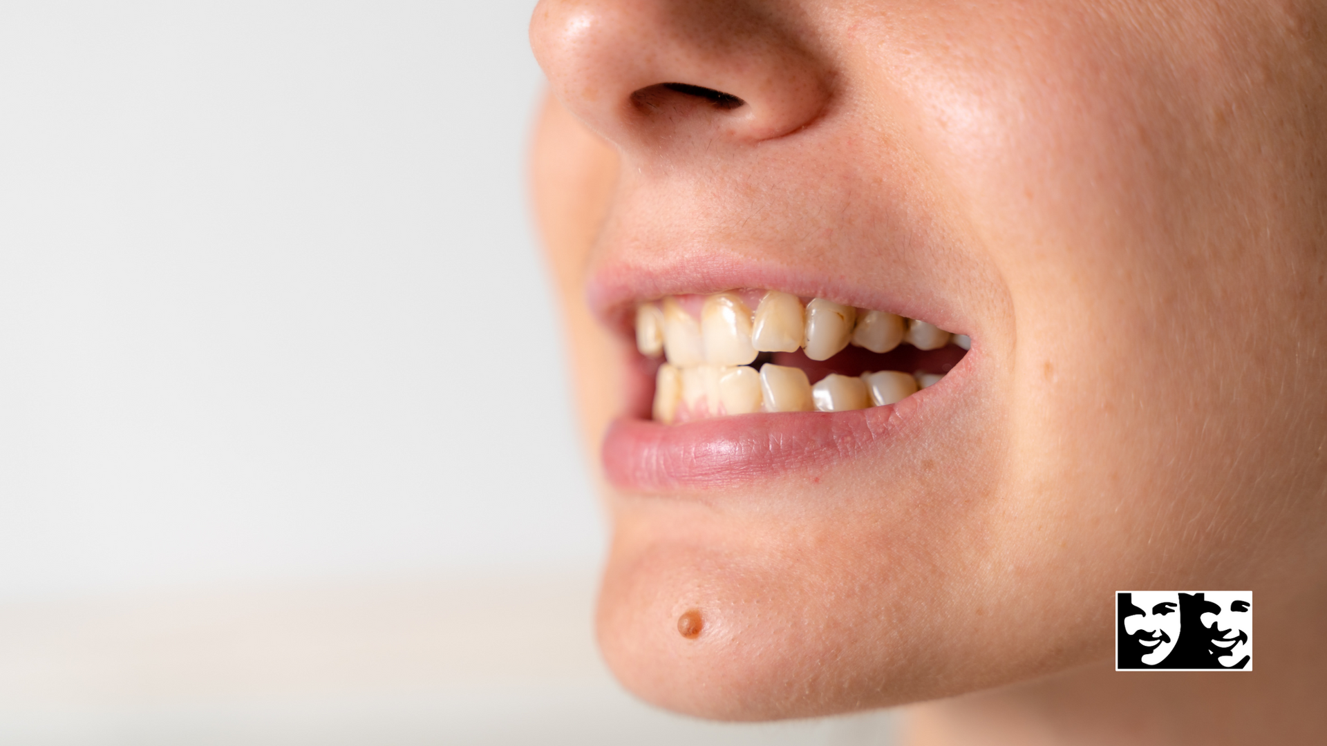 A close up of a woman 's mouth with her teeth showing.