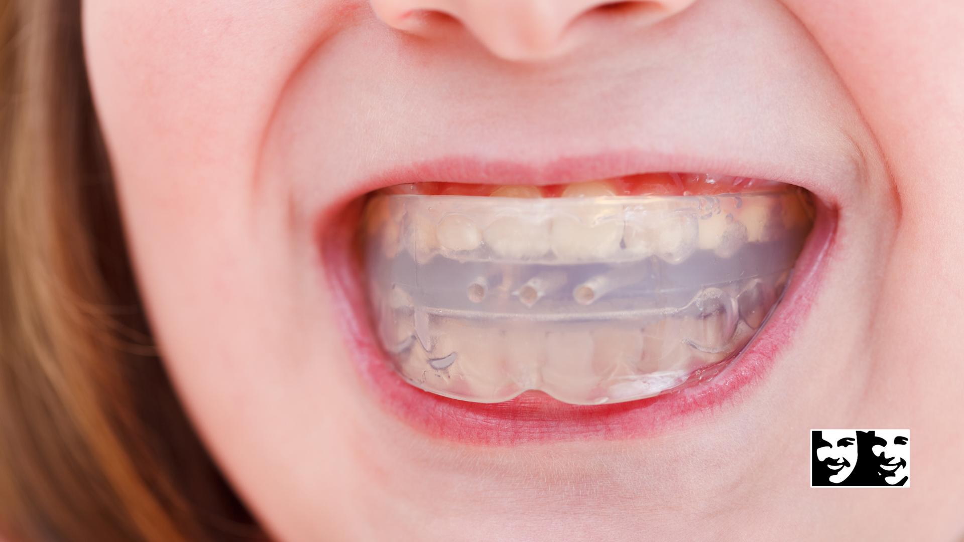 A close up of a person 's mouth with braces on their teeth.