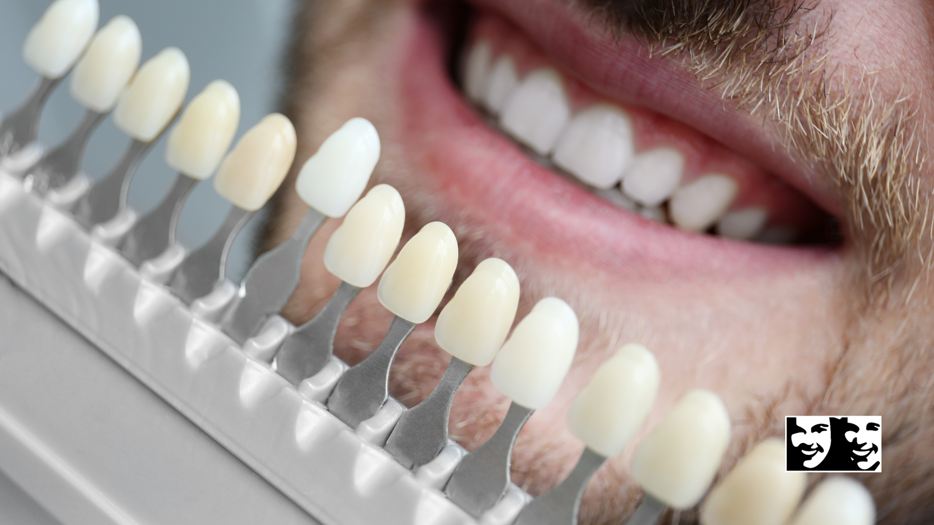 A close up of a man 's teeth next to a tooth color chart