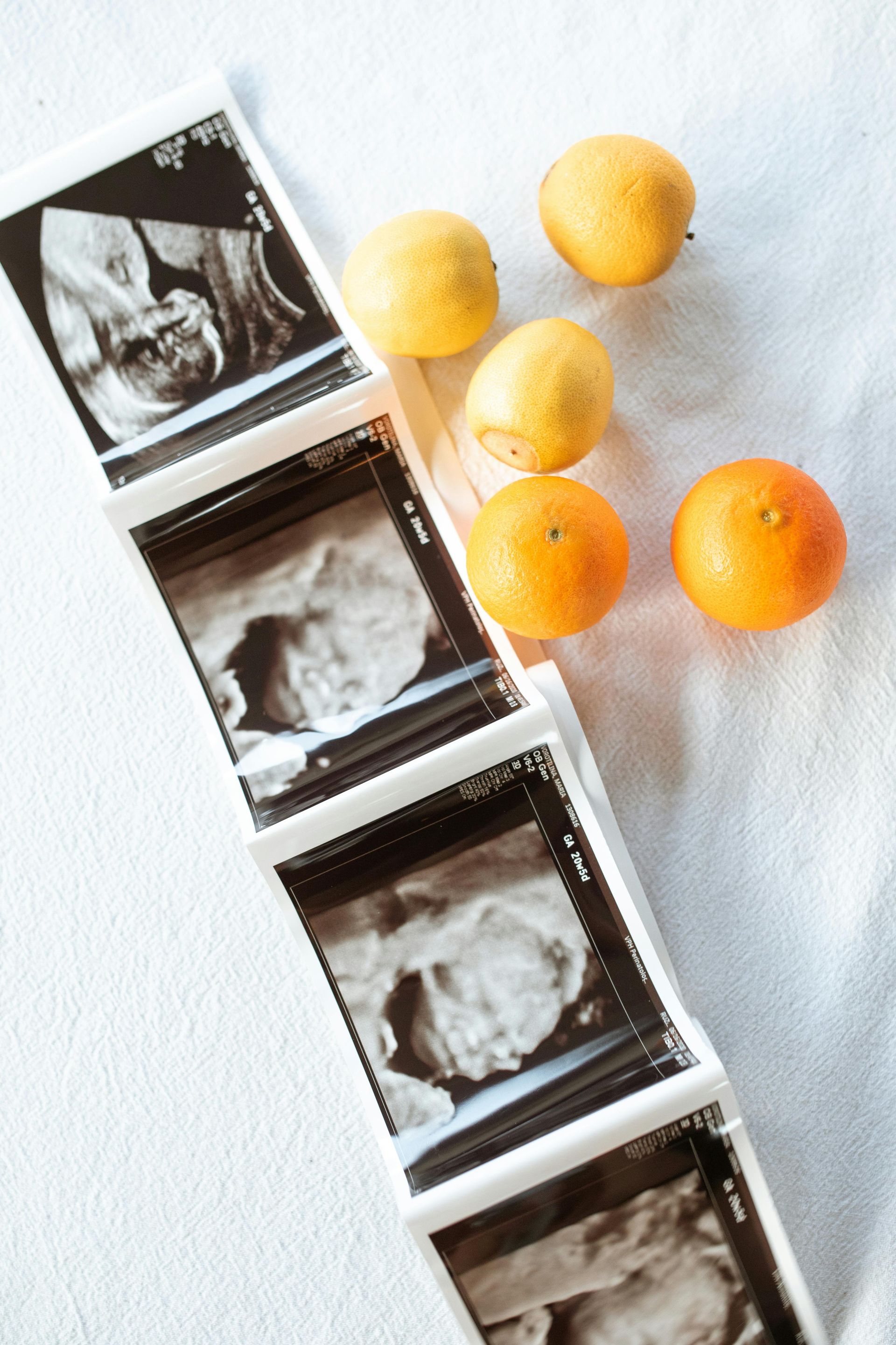 Ultrasound photos of a baby laid out with oranges and lemons on a white surface.