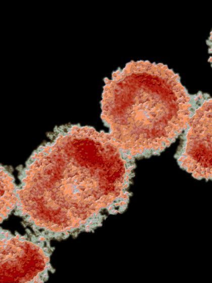 A computer generated image of a virus on a black background .