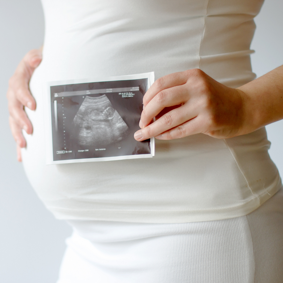 Ontdekking van baby met 3D en 4D pretechografie.