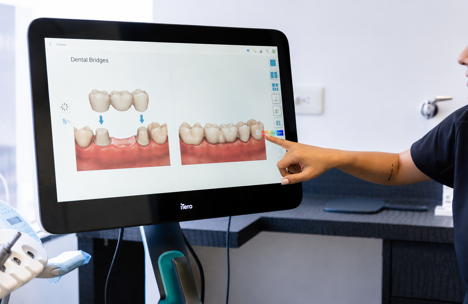 Dentist pointing at digital dental implant treatment plan