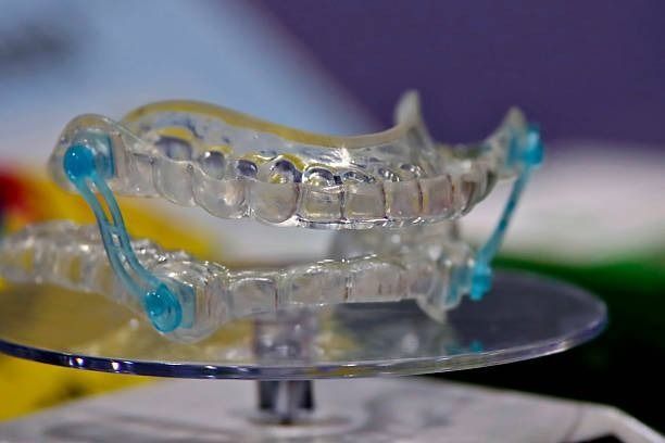 Clear dental aligner on a stand with blue bands in a close-up studio shot