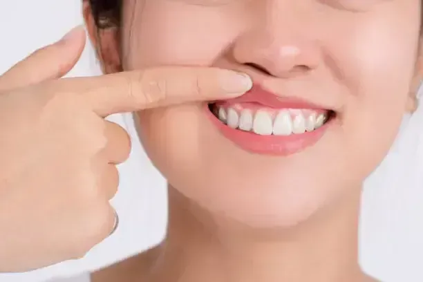 Close-up of a smiling person pointing to a front tooth with a finger
