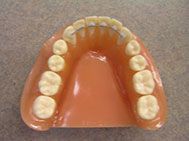 photo of invisible retainer
