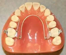 photo of W-Arch appliance