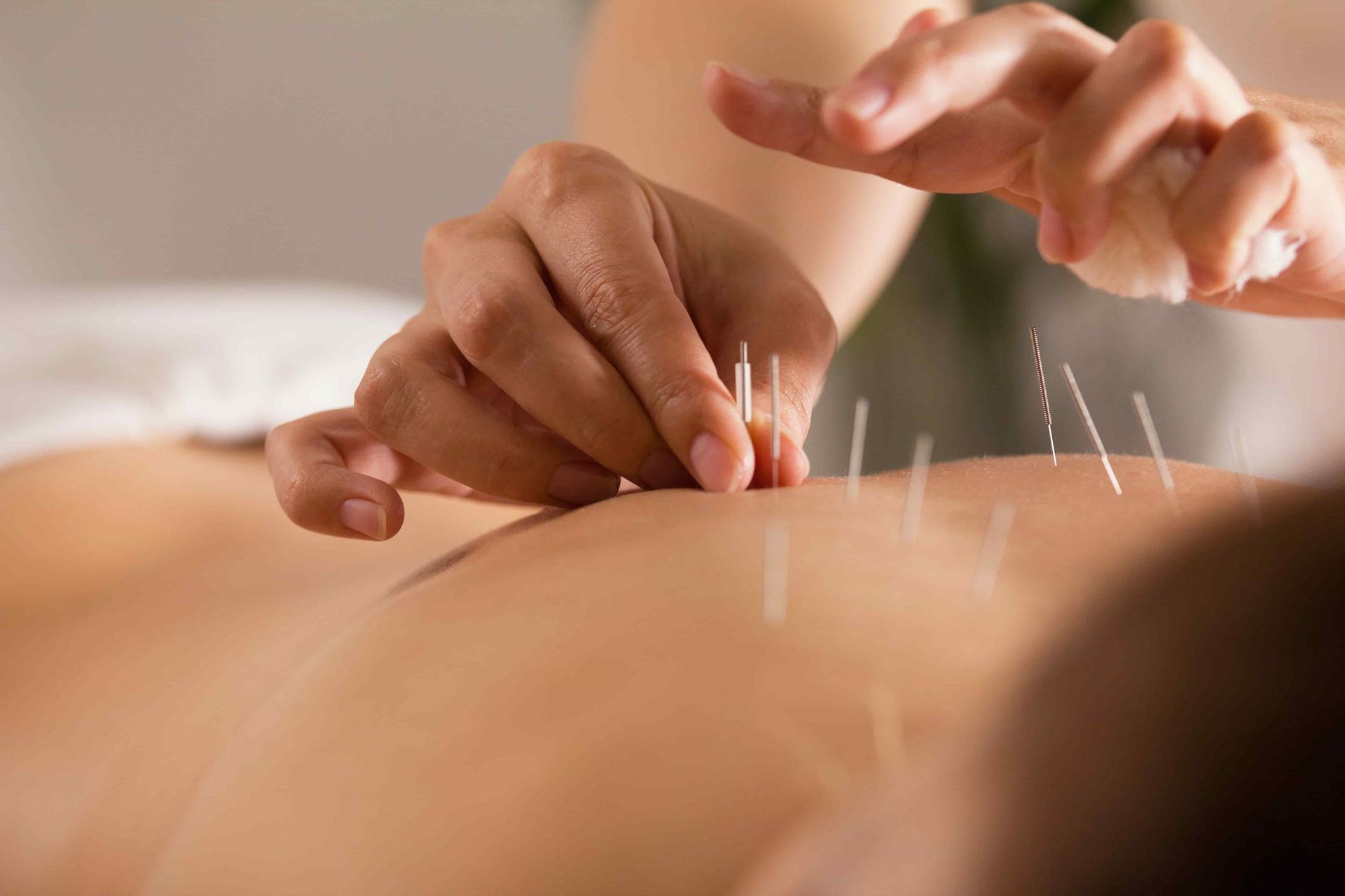 6 Signs That Acupuncture Is Working