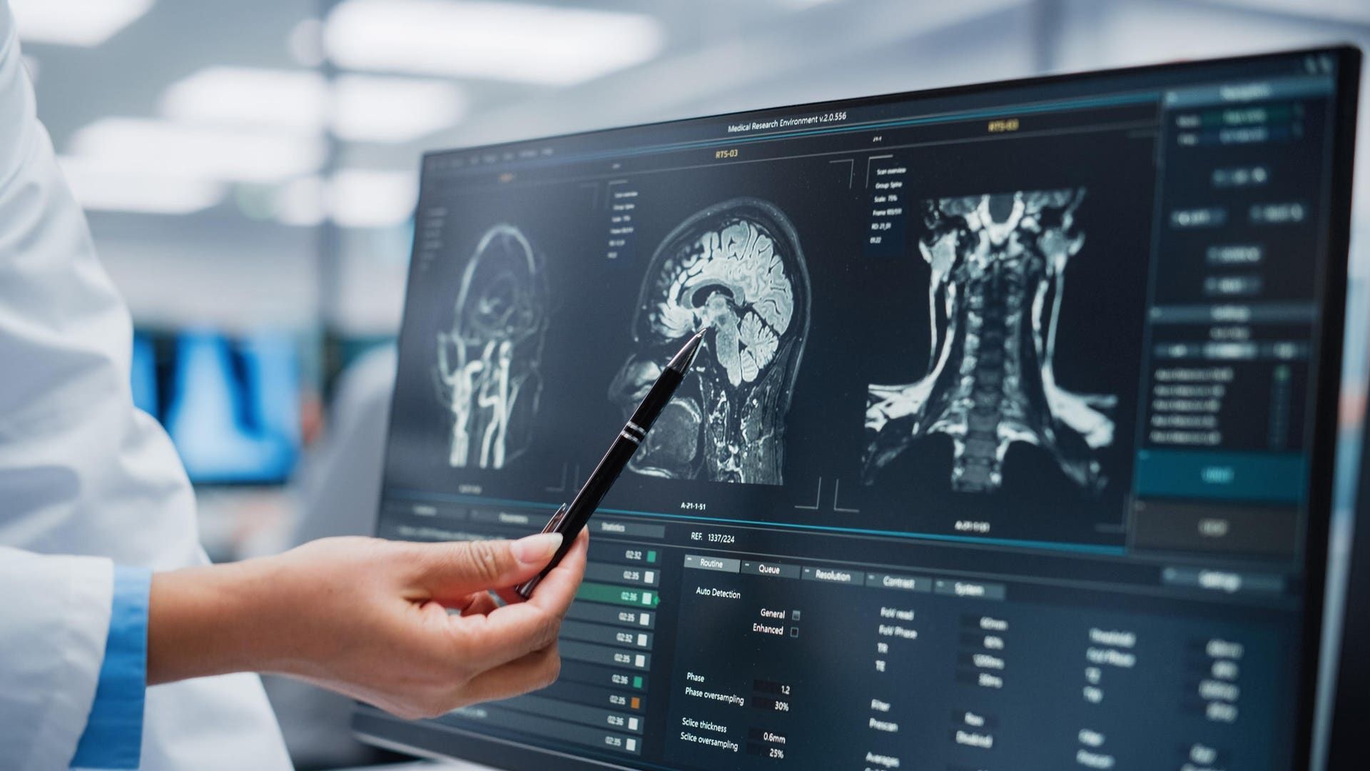 Doctor pointing at brain scan on a computer screen.