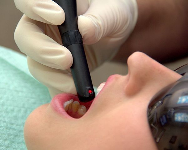 A person is getting a laser treatment on their teeth