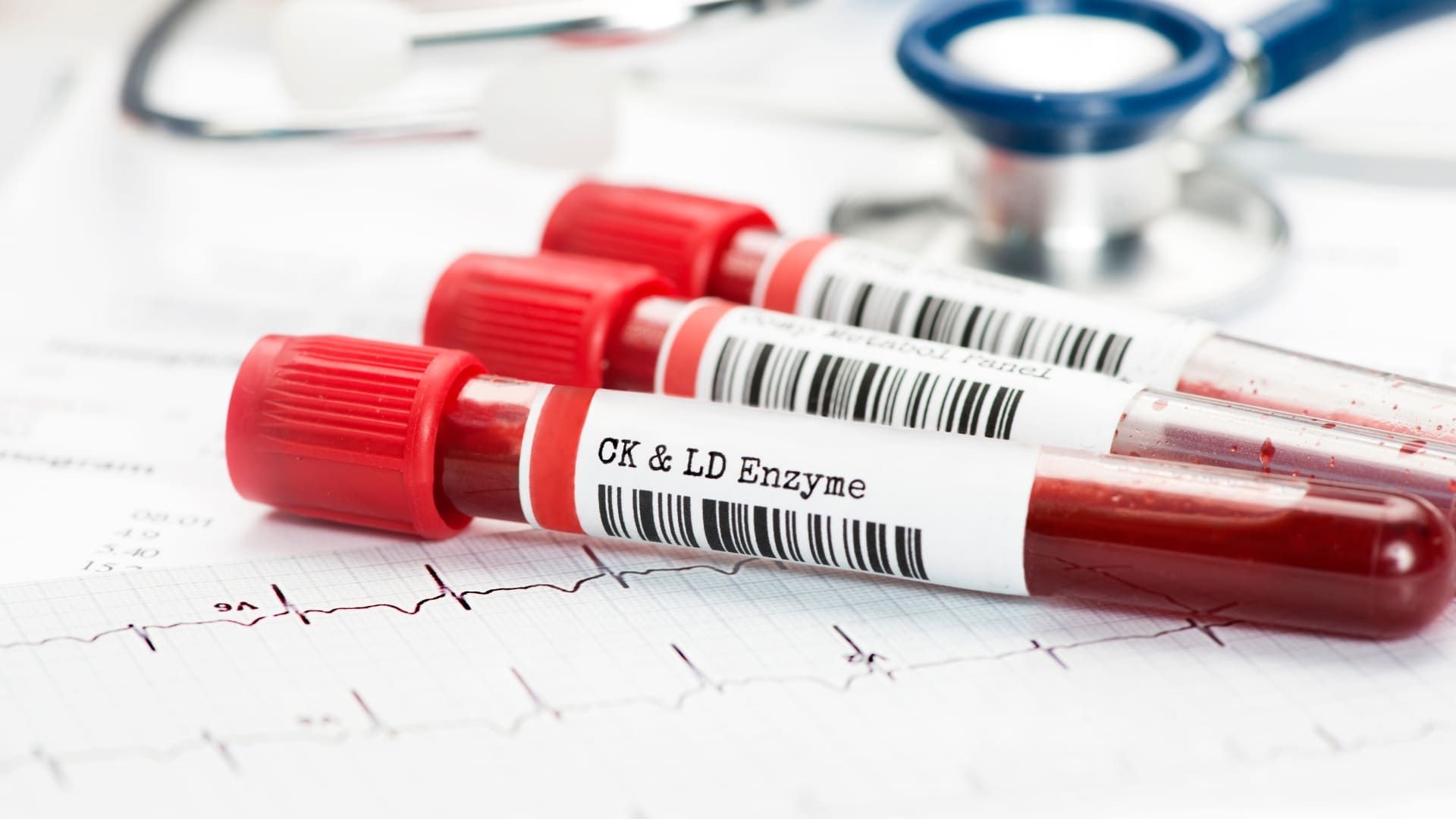 Blood Sugar Tests.