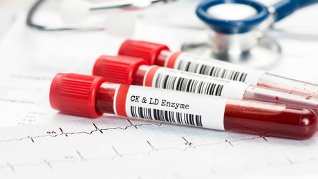 Blood Sugar Tests.