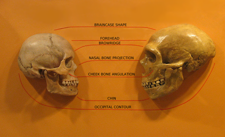 Two skulls side by side, labeled to show differences in braincase shape, brow ridge, nasal bone, cheekbones, chin, and occipital contours.