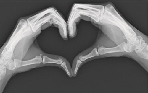 X-ray of two hands forming a heart shape.